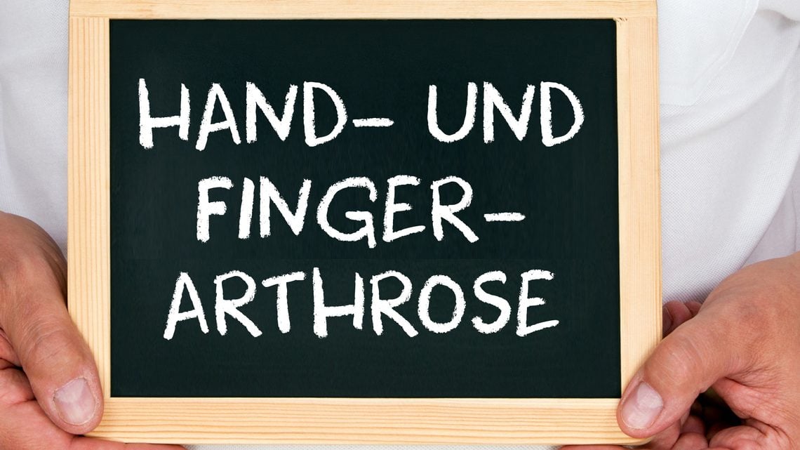 Hand- und Fingerarthrose: Überblick