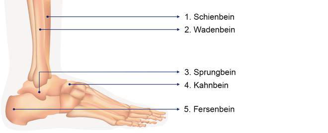 Sprunggelenksarthrose: Überblick | Arthrose